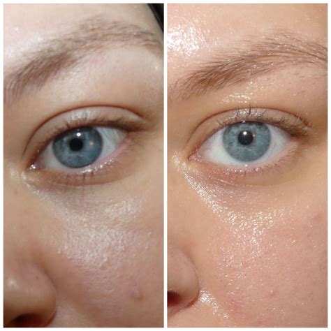 Before and After Retinol Eye Serum - Beauty Insider Community