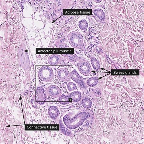 Pin on Histology - Skin