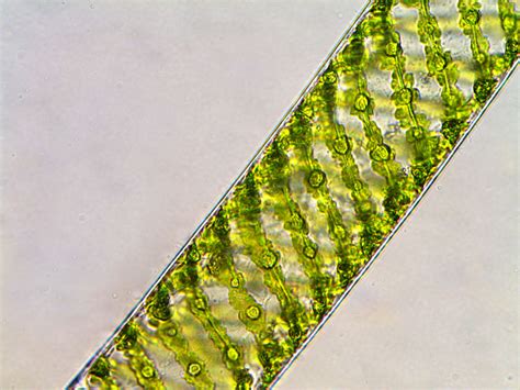 Spirogyra