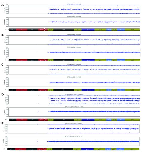 SNP-array analysis on placenta and fetal tissues of Case 1. (A ...