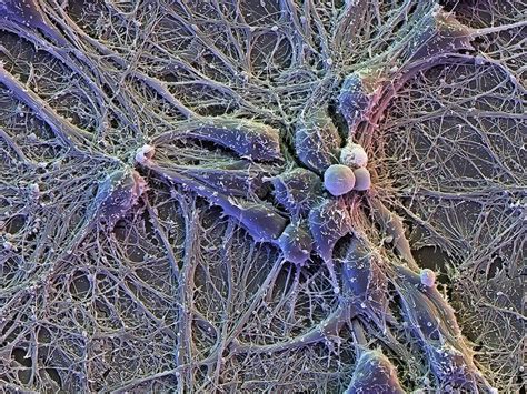 Brain cells, SEM - Stock Image - C016/7142 - Science Photo Library