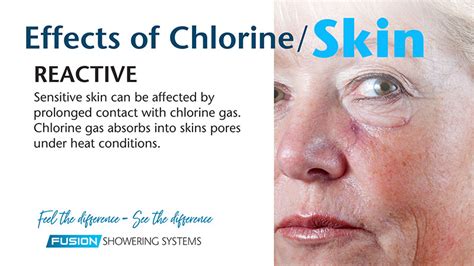 Effects of Chlorine on Skin - Beauty Shower by Fusion Technologies