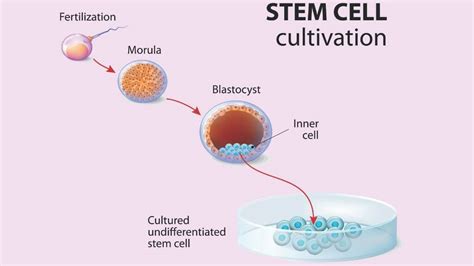 5 Stem Cell Therapy Benefits for Heart Disease, Joint Pain, & More ...