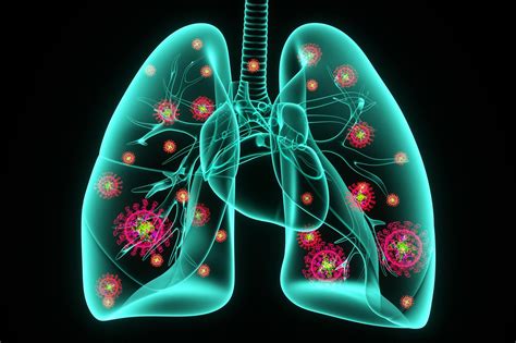 Long COVID-19 May Stem From an Overactive Immune Response in the Lungs