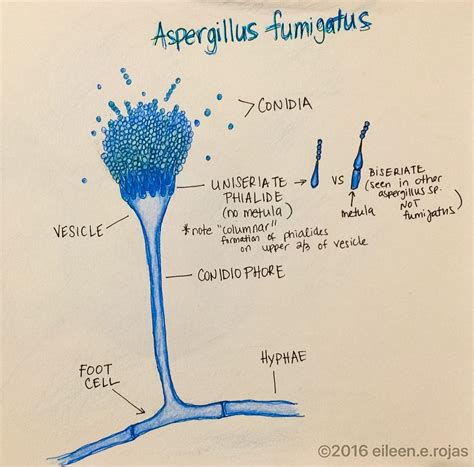 Aspergillus fumigatus - Chaetomium Queen | Medical laboratory science ...