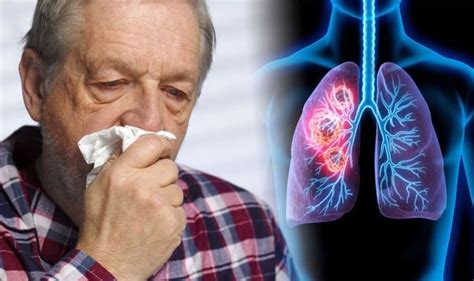 Lung cancer symptoms: Blood in your phlegm when you cough can be a sign ...