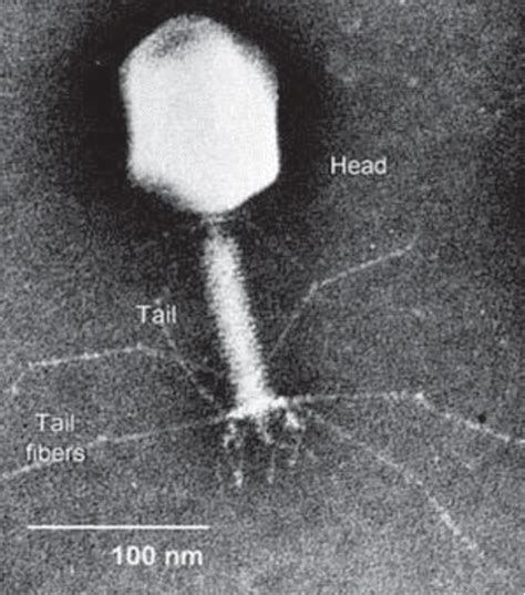 Electron micrograph of a bacteriophage | Download Scientific Diagram