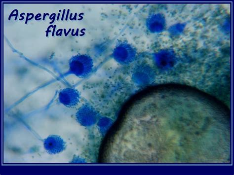 Fun With Microbiology (What's Buggin' You?): Aspergillus flavus