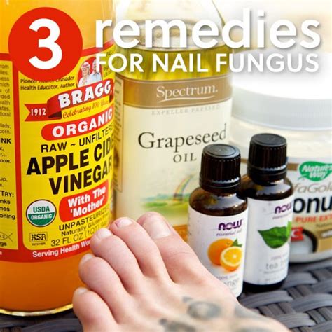 3 Simple Home Remedies for Toenail Fungus | Everyday Roots