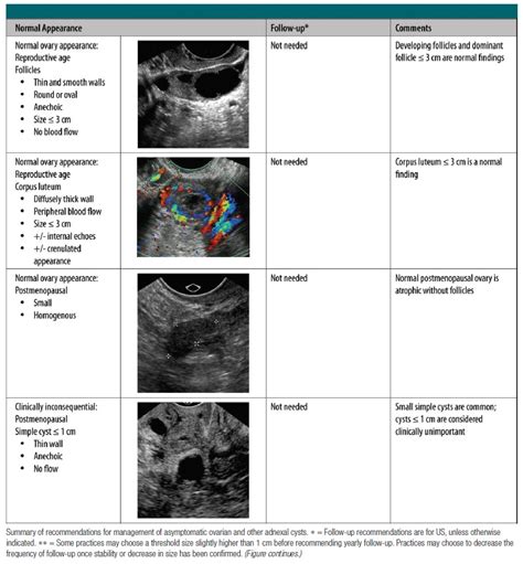 Ovarian Cyst F/U Guideline – Radiology.World