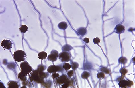 Mold & Indoor Air Quality: 3 Common Aspergillus Species | Business ...