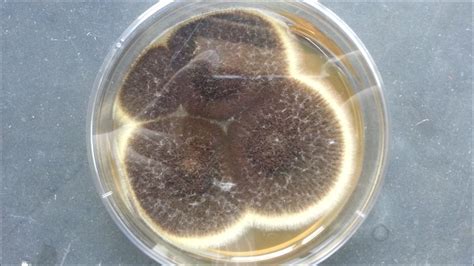 Aspergillus fumigatus in LPCB showing conidia Archives - Medical Notes