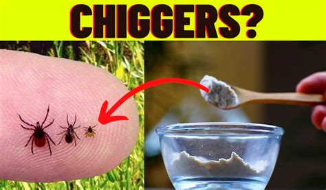 How to Easy Get Rid of Chiggers in Your Yard in 2022