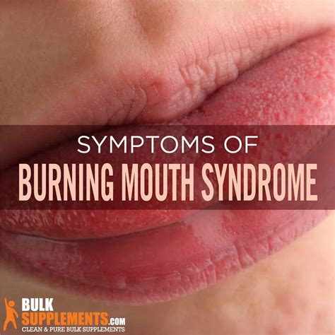 What Causes Numbness In The Tongue And Lips | Lipstutorial.org