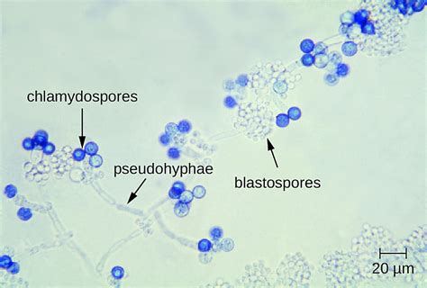 File:Candida pseudohyphae, chlamydospores, blastospores.png - HandWiki