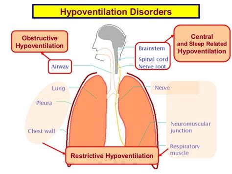 1 hypoventilation disorders