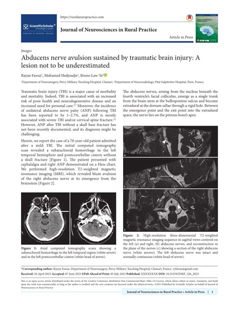 (PDF) Abducens nerve avulsion sustained by traumatic brain injury: A ...