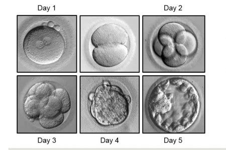 In Vitro Fertilization (IVF) | Fertility & Reproductive Medicine Center ...