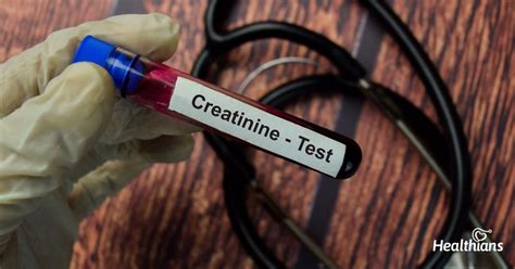 Creatinine Serum Test: Everything you need to know