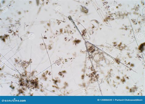 Marine Aquatic Plankton Under the Microscope View Stock Photo - Image ...