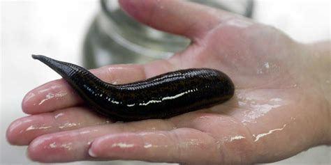 The 10 Most Horrifying Parasites that Infect Humans