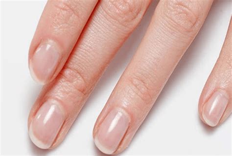 10 Warnings That Your Fingernails Are Indicating – Natural Home ...