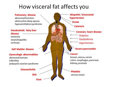 Visceral Fat