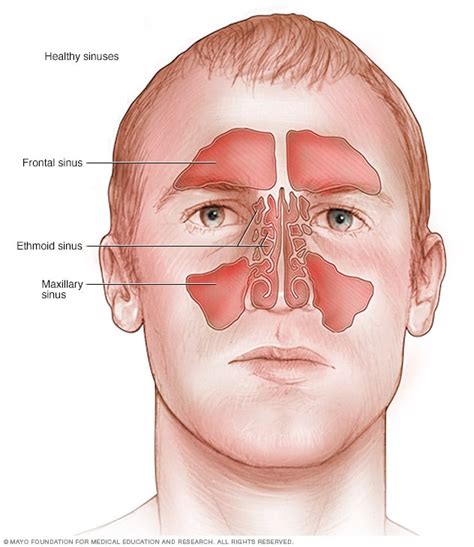 How To Reduce Swelling In Sinuses - Longfamily26