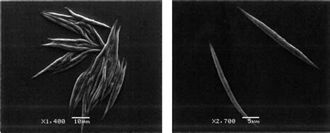 Pure culture of Ankistrodesmus falcatus viewed under a scanning ...