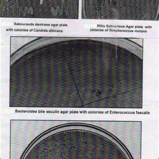 Cultured plates after incubation | Download Scientific Diagram