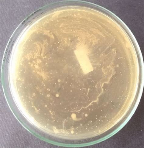 Nutrient Agar media showed the bacterial growth of sample B in third ...