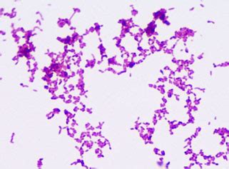 √ e coli microscope 100x 276577-How does e coli look under a microscope