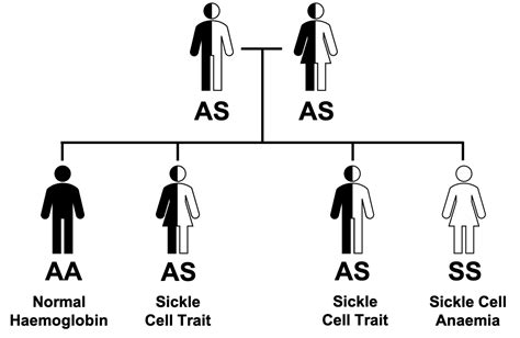 Sickle Cell Anaemia | Geeky Medics