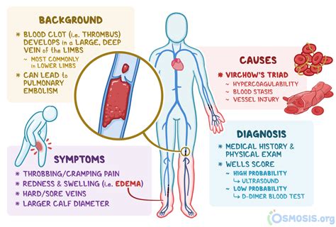 Deep Vein Thrombosis: What is it, Causes, Prevention, and More | Osmosis