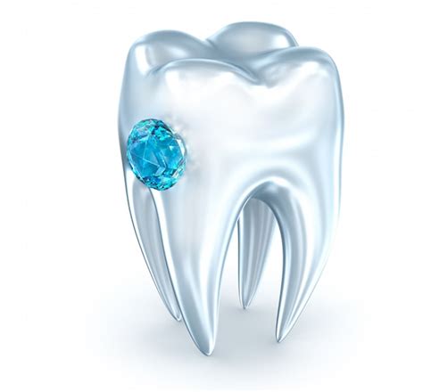 Diamonds on Teeth | American Cosmetic Dentistry