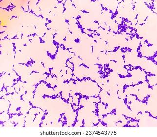 Klebsiella Pneumoniae Colonies Gram Stained Analyzed Stock Photo ...