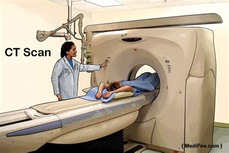 Things You Should Know About CT Scan Procedure,Cost