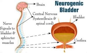 My Family Medicine Practice: Introduction to Neurogenic bladder