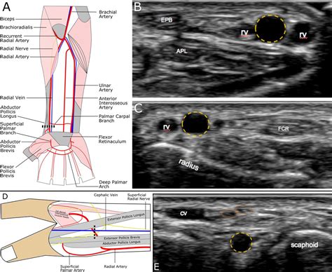 Radial Artery Location