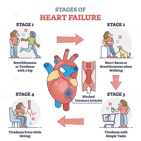 How To Improve Time To Diagnosis In Acute Heart Failure