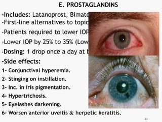 Glaucoma | PPT