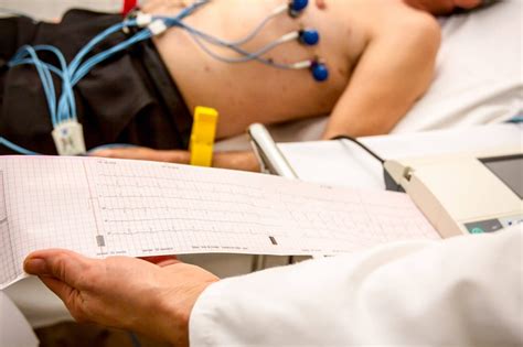 12 Lead Electrocardiogram (ECG) in Australia - Dr Arthur Nasis