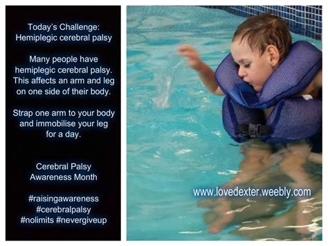 Understanding Hemiplegic Cerebral Palsy - Love Dexter