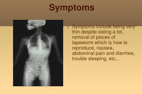 PPT - The tapeworm PowerPoint Presentation, free download - ID:5358896