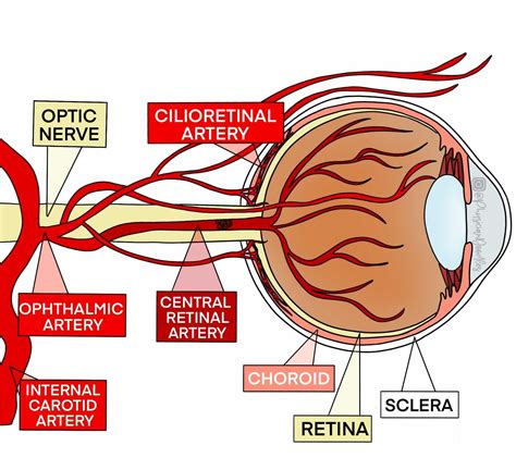 CRAO • The Eye Stroke – CriticalCareNow