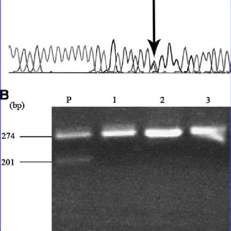 Analysis of the PTEN gene mutation. (A) Forward sequence of IVS5 and ...