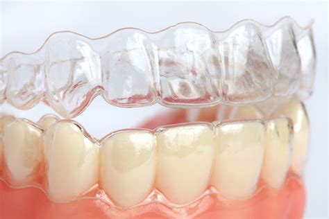 How much is the price of removable braces in the Philippines?