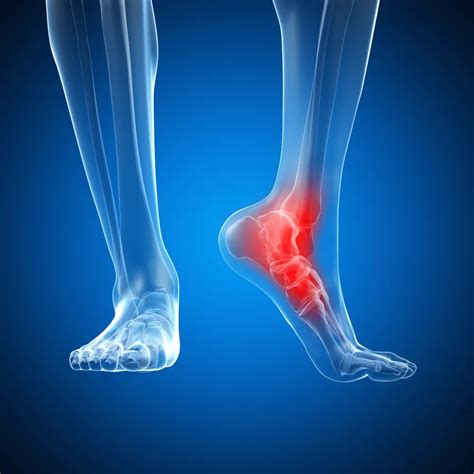 Ankle Pain: Symptoms, Causes and Treatment | STD.GOV Blog