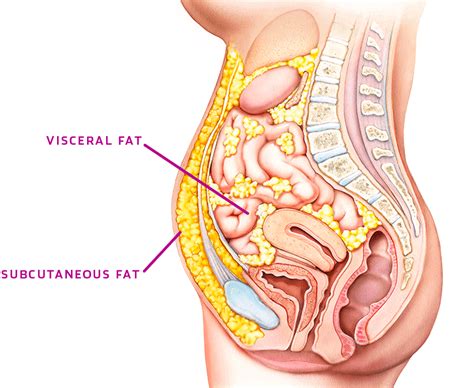 Visceral Fat vs. Subcutaneous Fat — What's the Difference? - Peter Attia