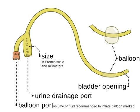 Foley catheter - Wikipedia